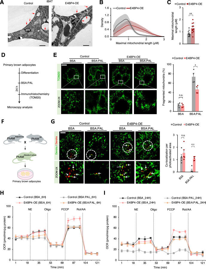 E4BP4 prevents obesity-induced mitochondrial fragmentation. (A) Transmission electron microscopy (TEM) of mitochondrial morphology in iBAT at 28-29 degrees C in Control and E4BP4-OE mice after 10 weeks of HFD feeding. Representative image. Scale bar: 2 um. Red arrows show mitochondria. (B) Kernel density plot of maximal mitochondrial length of (A). (C) Quantification of maximal mitochondrial length (n = 3 per group). Data were presented as mean +/- SEM. (D) Schematic illustration of experimental design for (E). (E) Right: Images of mitochondrial morphology in primary brown adipocytes by TOM20 immunofluorescence after 24 h of control treatment (BSA) or palmitate stimulation (BSA:PAL). Representative image. Scale bar, 10 um. Left: Quantification of cells with a fragmented mitochondrial network (n = 4; 100-220 mitochondria from ten images/group/experiment). Data were presented as mean +/- SEM. (G) Left: live-cell fluorescence of MitoDendra2 in primary brown adipocytes infected with AAV-control or E4BP4. Representative image. Scale bar, 12 um. Right: Quantification of colocalization of Dendra active and not-activated. Data were presented as mean +/- SEM. (H) Oxygen consumption rate (OCR) in differentiated primary brown adipocytes expressing Control or E4bp4 after pretreatment for 6 h with control treatment (BSA) or palmitate stimulation (BSA:PAL).