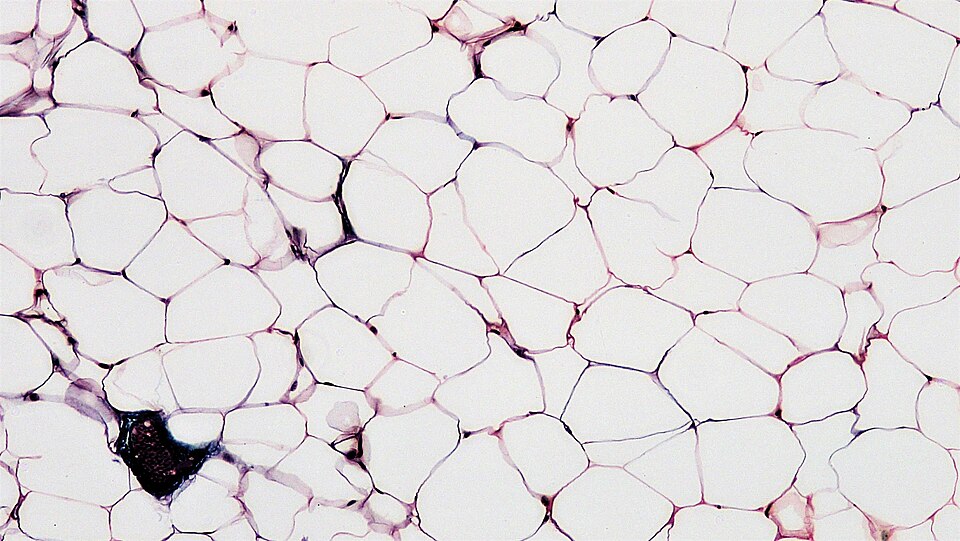 Adipose connective tissue, light micrograph; unilocular white adipocytes with sparse cytoplasm and peripheral nucleus embedded in connective tissue stroma