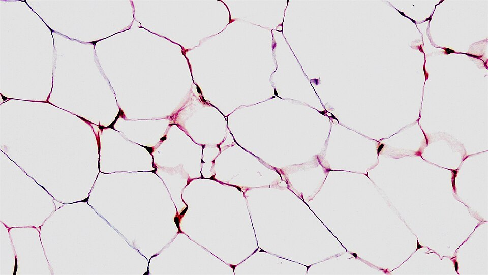 Adipose connective tissue cross-section, light micrograph 200x; unilocular white adipocytes showing signet-ring appearance after lipid extraction during processing