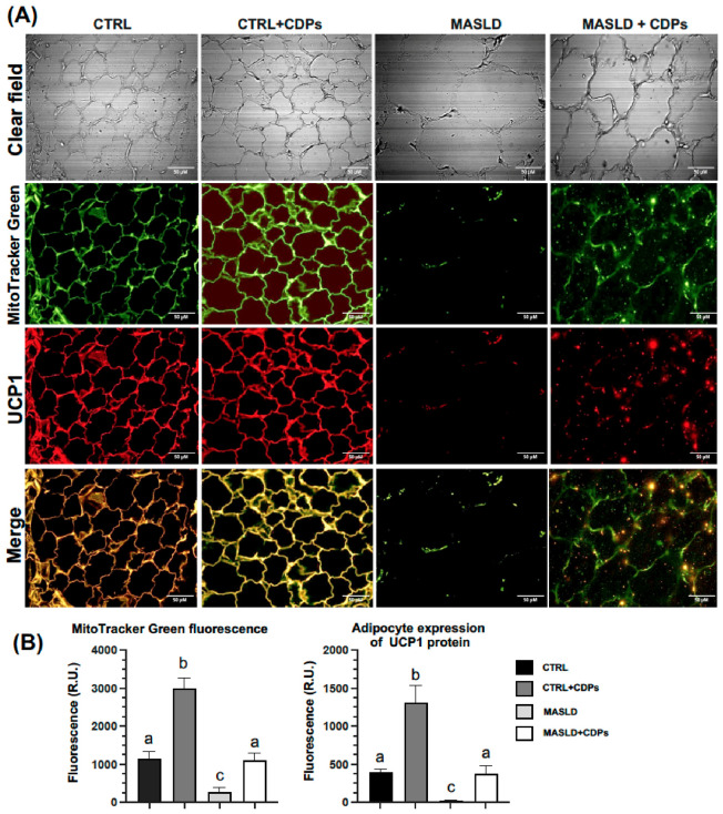 Confocal analysis of visceral adipose tissue from rats with MASLD treated with CDPs. ( A ) Representative confocal microscopy images of visceral adipose tissue sections stained with Propidium Iodide (PI), MitoTracker Green, and anti-UCP1 antibody, with clear-field images shown (20x magnification). Scale bar = 50 um. Animal groups are defined in Figure 2 . ( B ) Quantification of fluorescence intensity using MitoTracker Green staining and UCP1 immunodetection. VAT samples from six animals per animal group ( n = 6) were dissected and processed for staining. Fifteen representative microscopic fields acquired from the six animals in each experimental group were analyzed to quantify fluorescence. Bars represent the means +/- SEM, n = 6 animals per group. Statistical analysis was performed using one-way ANOVA, followed by Tukey's post hoc test. Different lowercase letters indicate significant differences ( p < 0.05).