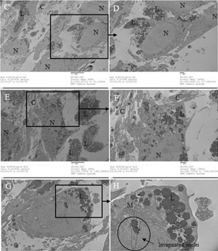 Transmission electron microscopy of dedifferentiated fat (DFAT) cells derived from human adipose tissue. After 7 days of ceiling culture on ACLAR, cells show multiple lipid droplets (L), mitochondria (M), nucleus (N), and collagen (C), demonstrating adipocyte plasticity and return to a progenitor-like state.