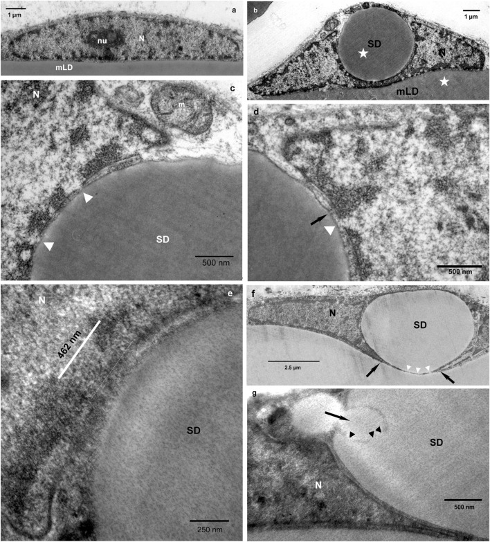 (a) Adipocyte nucleus (N) with a pronounced nucleolus (nu) without indentation in non-lipedema control tissue (sagittal plane). The nucleus appears flat, adapting its form to the curvature of the mature adipocyte and is closely attached to the main lipid droplet (mLD). (b) Lochkern in a lipedema adipocyte (sagittal plane). The bulging of the nucleus, due to the indentation, is seen. Electron optical analysis clearly indicates that the content of the satellite droplet (SD) and the mLD is identical (asterisks). (c) Ultrathin sections showing the contact zone between the nucleus and the SD at the nuclear pore (arrowheads). A mitochondrion is seen within the adipocyte cytoplasm (m). (d) A channel-like stucture connects the SD with the adjacent heterochromatin (arrow) and the nuclear pore contact (arrowhead). (e) High magnification of a strongly extended contact region [462 nm, measured by ImageJ] between a satellite droplet and the nuclear membrane. (f) A Lochkern showing a fenestration for passage of the satellite droplet to the main droplet. Black arrows indicate the opening within the nuclear membrane, white arrowheads point to the dissolution of the phosholipid membrane. (g) A lateral small lipid droplet is fusing (black arrow) with the large satellite droplet. This fusion process (arrowheads) is identical with fusion of normally generated LDs during lipogenesis.