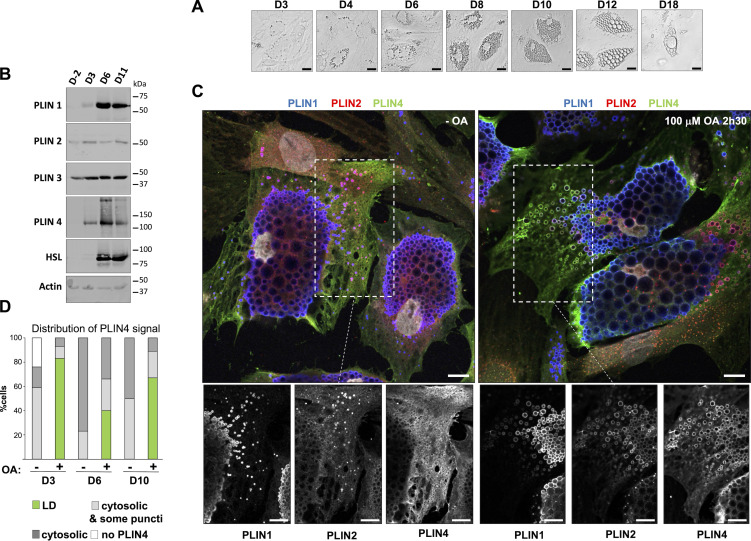 Analysis of endogenous PLINs in human adipocyte (TERT-hWA) cultures suggests different modes of interaction with LDs. (A) Time course of adipocyte differentiation. (B) Western blot analysis of adipocyte markers and PLINs during adipocyte differentiation. P: proliferation; D3, D6, and D11: day of differentiation. (C) Representative z sections obtained by confocal fluorescence microscopy of endogenous PLIN1 (blue), PLIN2 (red), and PLIN4 (green) in human adipocytes at day 10 of differentiation after immunofluorescence with specific antibodies, with the nuclei stained with DAPI (white). Bottom panels show the three protein channels in the indicated area. The cells were maintained in culture medium or fed with 100 uM oleic acid for 2.5 h before observation. Scale bar: 10 um. (D) Quantification showing the fraction of cells with PLIN4 signal as indicated under the same conditions as in C. Four categories were defined: cells without detectable PLIN4; cells in which PLIN4 was entirely cytosolic; cells in which PLIN4 was mostly cytosolic but marked a few puncti (possible LDs); cells in which PLIN4 was LD-localized. N of cells quantified was 108 for D3 - OA, 104 for D3 + OA, 92 for D6 - OA, 92 for D6 + OA, 98 for D10 - OA and 93 for D10 + OA, from one of two representative experiments.