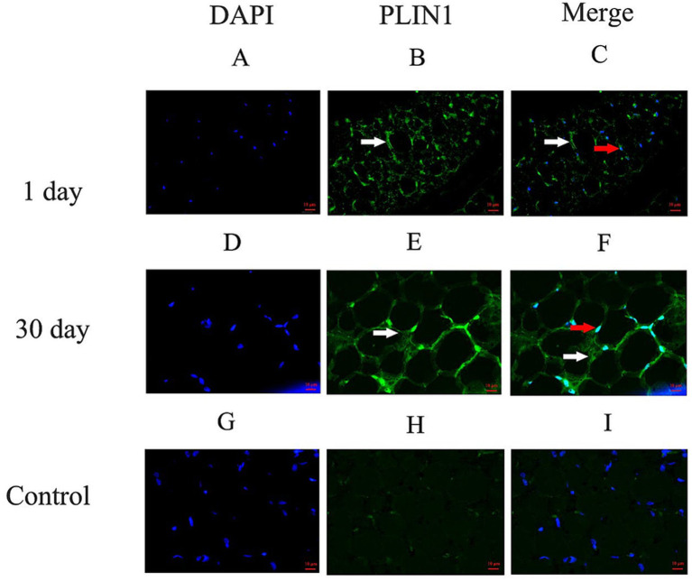 Immunofluorescence localization of PLIN1 on LDs in perirenal adipose tissue of 1- and 30-days-old yak calves: (A-C) Perirenal adipose tissue at 1 day old; (D-F) Perirenal adipose tissue at 30 days old; (G-I) Negative controls. White arrows indicate PLIN1-positive on LD in adipocytes, red arrows indicate nuclei of PLIN1-positive adipocytes. Scale bars: 10 um.
