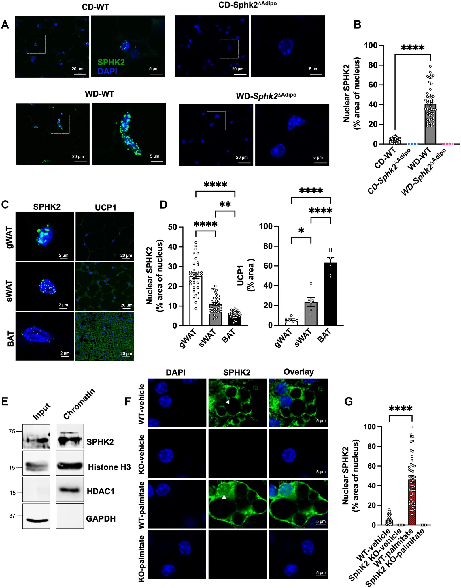 WD enhances nuclear localization of SPHK2 in SWAT. (A) Representative confocal micrographs of sWAT from 18 week chow or WD fed Sphk2 DeltaAdipo and WT male mice were stained for SPHK2 and counterstained with DAPI and then quantified (B) as % SPHK2-stained area per nuclei (N = 6, n = 8). (C) Representative confocal micrographs of sWAT, gWAT, and BAT from WT mice stained for SPHK2 or UCP1 and counterstained with DAPI and were quantified (D) as % SPHK2-stained area per nuclei or as % UCP1-stained area per field (N = 4, n = 8). (F) Representative immunofluorescence images of WT or Sphk2 knockout (KO) primary adipocytes treated with vehicle or palmitate (500 uM) for 24 hours and were quantified (G) as % SPHK2-stained area per nuclei (N = 6, n = 8). Scale bars, 5 um.