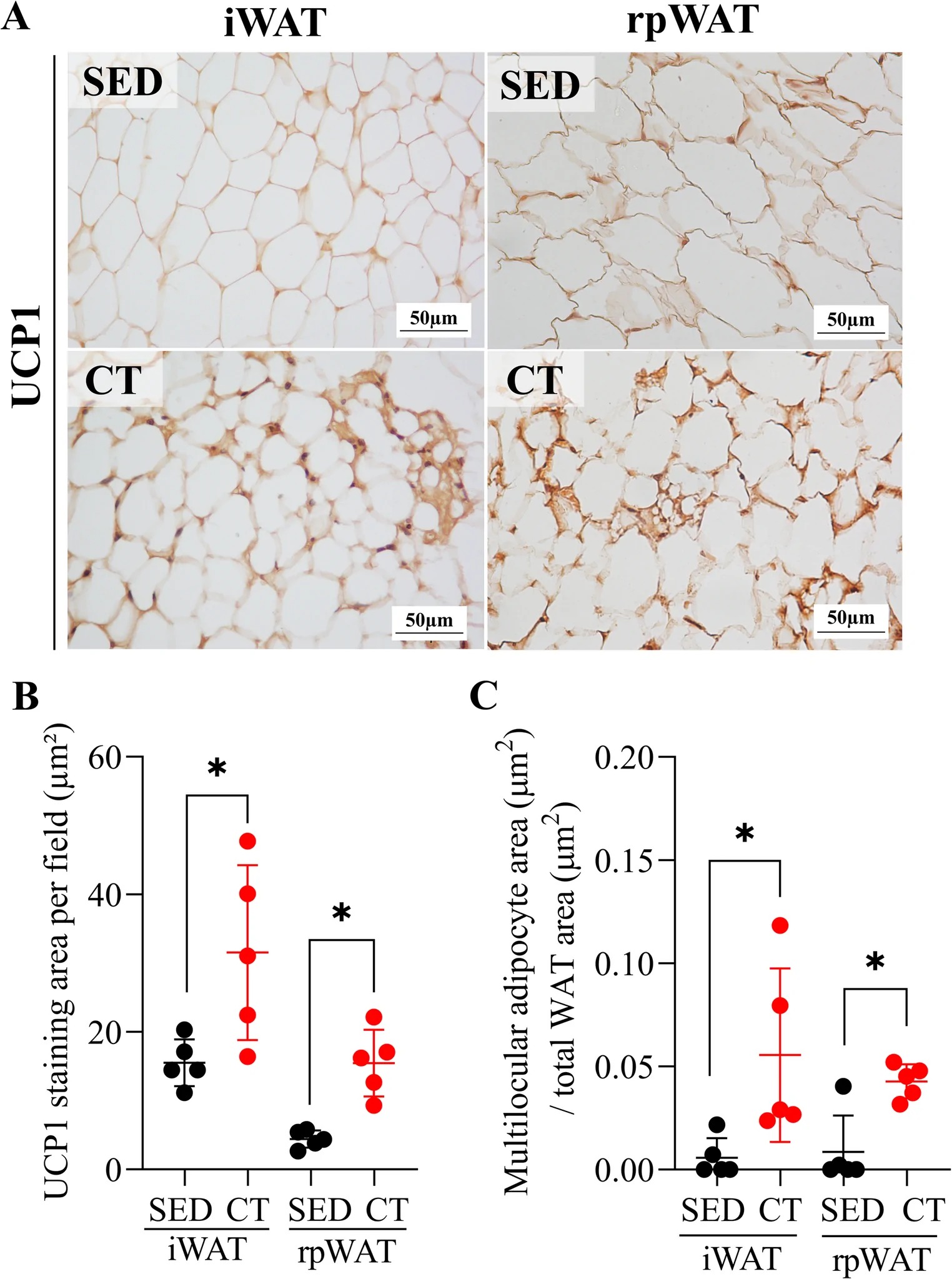 CT increased UCP1 expression in iWAT and rpWAT after 8 weeks. (A) Representative immunohistochemistry images of UCP1 staining in iWAT and rpWAT; (B) UCP1 positive-staining area per field (um2) in each adipose tissue depot; and (C) Multilocular adipocyte area normalized to the total WAT area analyzed. Data are presented as mean +/- SD. Comparisons between SED and CT were performed using an unpaired two-tailed Student's t-test. *p < 0.05 versus the corresponding SED group. Scale bars, 50 um. Abbreviations: SED, sedentary (n = 5 animals); CT, combined training (n = 5 animals); WAT, white adipose tissue; iWAT, inguinal white adipose tissue; rpWAT, retroperitoneal white adipose tissue; UCP1, uncoupling protein 1.