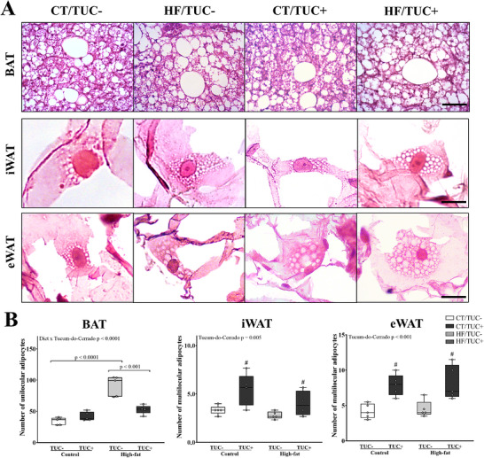 Unilocular and Multilocular adipocytes of adipose tissue from rats. (A) Representative histological images of unilocular adipocytes in brown adipose tissue (BAT) and multilocular adipocytes in inguinal (iWAT) and epididymal (eWAT) adipose tissues. Stain: hematoxylin and eosin. Scale bar: 10 μm (BAT) and 5 μm (iWAT and eWAT); (B) Quantification of unilocular adipocytes in BAT and multilocular adipocytes in iWAT and eWAT. Values are presented as box plots with whiskers from minimum to maximum (n = 5/group). *p < 0.05 effect of diet; # p < 0.05 effect of Tucum-do-Cerrado.