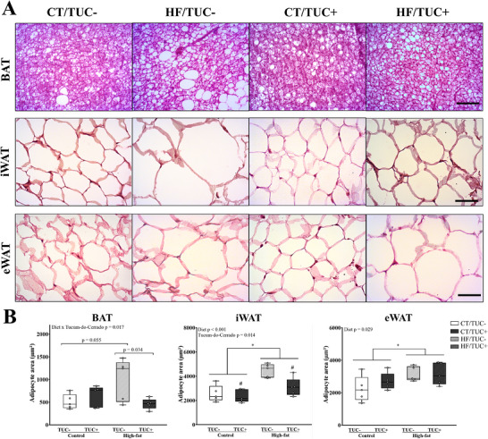 Histological images of adipose tissues of rats. (A) Morphological evaluation of Brown (BAT), inguinal (iWAT), and epididymal (eWAT) adipose tissues. Stain: hematoxylin and eosin. Scale bar: 20 μm (BAT) and 10 μm (iWAT and eWAT). (B) Quantification of unilocular adipocyte area. Values are presented as box plots with whiskers from minimum to maximum (n = 5/group). *p < 0.05 effect of diet; # p < 0.05 effect of Tucum-do-Cerrado.
