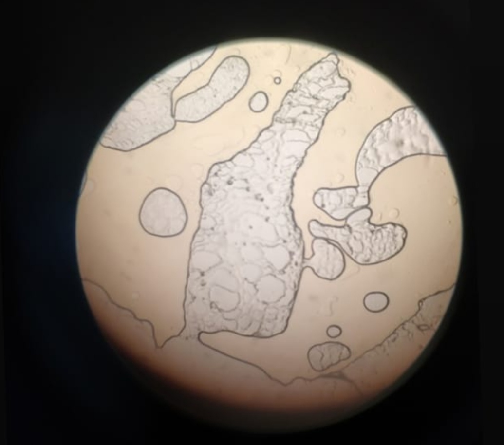 Human adipose tissue cell, light microscopy from a medical college microbiology class. White adipocytes show the unilocular empty space after lipid extraction with a thin cytoplasm rim and peripheral nucleus.