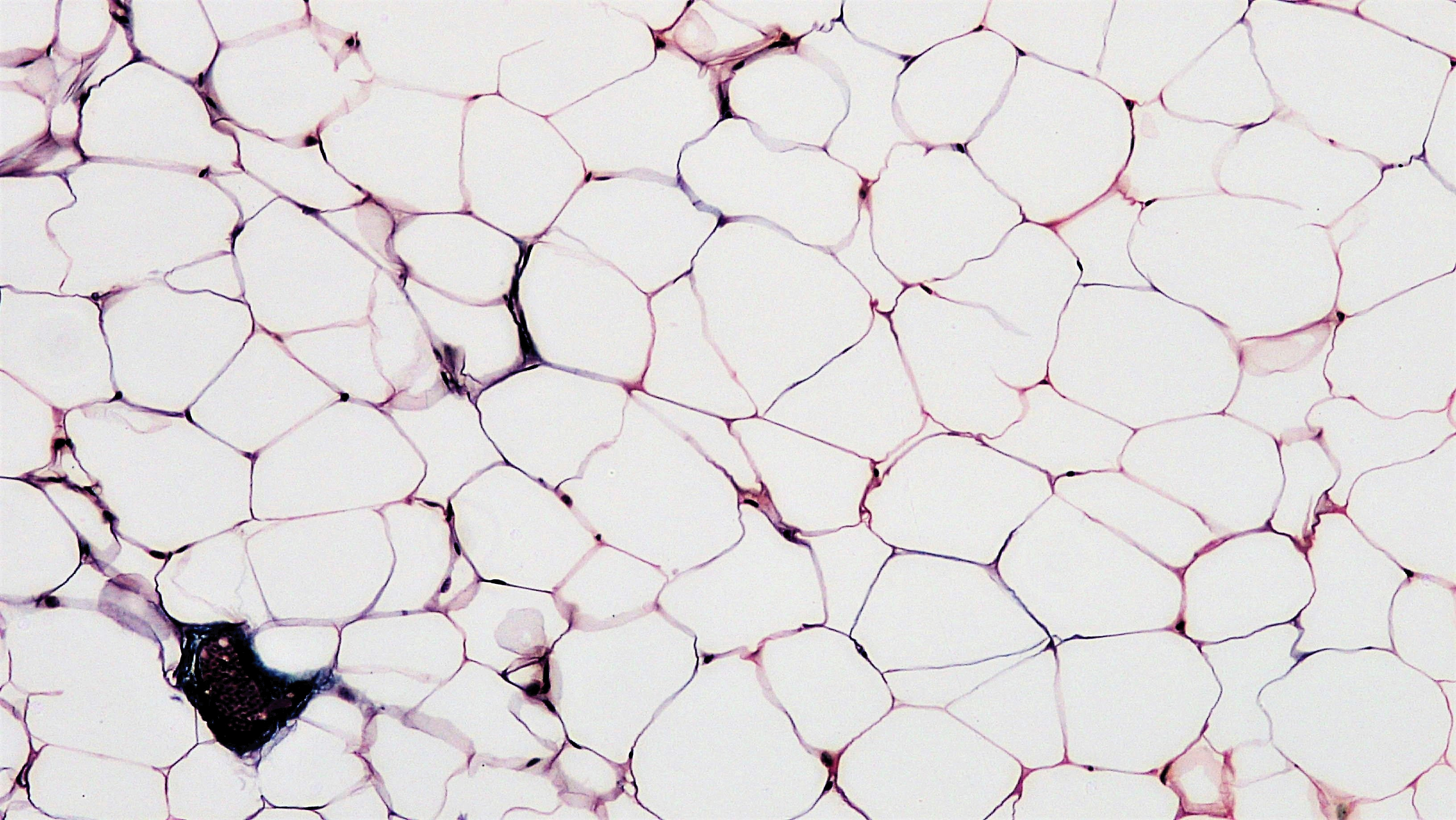 White adipose connective tissue, 200x magnification. Cross section showing lobules of unilocular adipocytes surrounded by thin connective tissue septa. From the Berkshire Community College Bioscience Image Library.