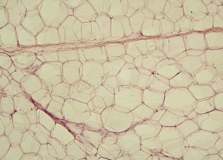 Yellow adipose tissue, paraffin section with lipids washed out during processing. The empty round spaces correspond to former lipid droplets dissolved by organic solvents. Thin cytoplasm rims and peripheral nuclei remain. From the Department of Histology, Jagiellonian University Medical College, Krakow.