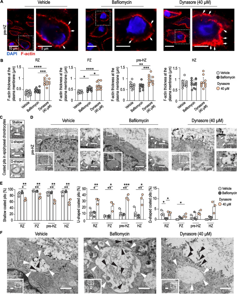 Endocytosis of cartilage matrix is impaired by dynasore. A-B Super-resolution microscopy images showing F-actin staining at the plasma membrane of pre-hypertrophic chondrocytes (white arrows) and quantification of the F-actin thickness in all zones. C Transmission electron microscopy (TEM) images of examples of shallow, U-shaped and Omega-shaped endocytic pits (white arrows) observed in the metatarsals. D Coated pits in pre-hypertrophic chondrocytes. Please, note the abundance of extracellular matrix (ECM) and fiber-like structures (black arrow heads) in the dynasore-treated group. E Quantification of shallow, U-shaped and Omega-shaped pits in the epiphysial cartilage. F TEM images reveal cartilage endocytosis in hypertrophic chondrocytes. Chondrocytes uptake collagen fibril-like electron-dense extracellular structures (black arrowheads) in endocytic-like pits/vesicles (white arrowheads). By contrast, dynasore-treated bones contained chondrocytes with over-accumulation of ECM in the extracellular space. RZ: resting zone; PZ: proliferative zone; HZ: hypertrophic zone.