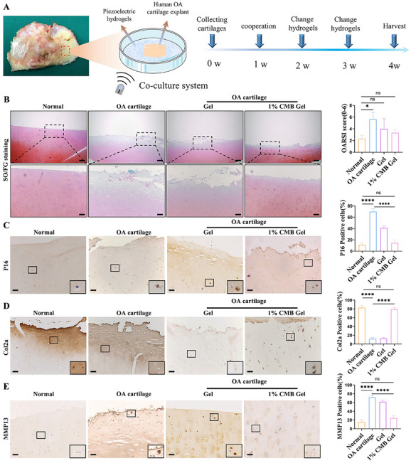 Therapeutic effect of piezoelectric hydrogel in human osteoarthritis cartilage samples. (A) Experimental design schematic. After culturing human osteoarthritis cartilage samples in vitro for one week, the hydrogel was replaced weekly, and cartilage samples were collected after 3 weeks. (B) SO/FG staining of different groups of cartilage samples. Scale bar, 200 um. (C, D, E) Immunohistochemical staining results of P16, COL2A1, and MMP13. Scale bar, 100 um. Statistical analysis was performed using one-way analysis of variance (ANOVA) combined with Tukey's post hoc test. n = 5, * p < 0.05, *** p < 0.001. ns, no significant difference.