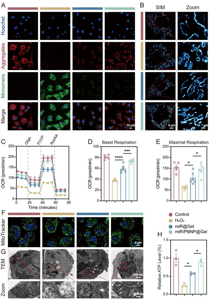 miR/PBNP@Gel restored mitochondrial function in OA chondrocytes. (A) JC-1 staining of mitochondrial membrane potential in chondrocytes under H2O2 (200 uM, 24 h) and different treatments. Red indicates JC-1 aggregates and green indicates JC-1 monomers (scale bar: 10 um). (B) SIM images mitochondrial cristae morphology in chondrocytes treated with H2O2 (200 uM, 24 h) with different materials (scale bar: 5 um), and zoom images highlight cristae structure (scale bar: 1 um). (C) Seahorse analysis of oxygen consumption rate over time in chondrocytes under H2O2 (200 uM, 24 h) and different treatments. (D-E) Quantitative analysis of basal respiration and maximal respiration (n = 6). (F) MitoTracker Green staining of mitochondrial morphology in chondrocytes treated with H2O2 (200 uM, 24 h) with different materials (scale bar: 5 um). (G) TEM imaging of chondrocyte mitochondrial ultrastructure following H2O2 (200 uM, 24 h) with different materials (scale bar: 500 nm), and zoom images highlight key structural details (scale bar: 200 nm). (H) Quantification of intracellular ATP content in chondrocytes treated with H2O2 (200 uM, 24 h) with different materials (n = 3). Data are presented as mean +/- SEM. *P < 0.05, ***P < 0.001, ***P < 0.0001.