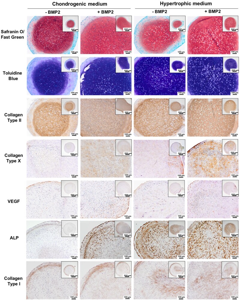 In vitro chondrogenesis of hBMSC microtissues differentiated with or without BMP2 in chondrogenic or hypertrophic conditions. Sections of cartilaginous microtissues from different culture conditions (+/-BMP2) (chondrogenic/hypertrophic medium) were stained for GAGs (Safranin O and Toluidine blue staining), collagen type I, collagen type II, collagen type X, VEGF and ALP after day 28 of culture.