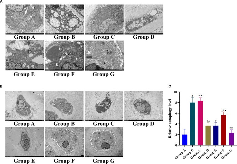 Histological section of rat knee articular cartilage showing chondrocytes within their lacunae against territorial and interterritorial matrix. Autophagy-related structural changes assessed across OA model groups.