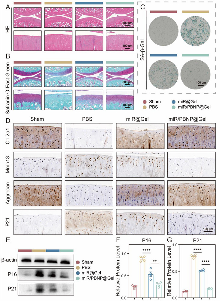 miR/PBNP@Gel attenuated chondrocyte senescence and improved cartilage matrix metabolism. (A) Hematoxylin and eosin staining of cartilage tissue morphology in different treatment groups. Up: overview (scale bar: 500 um); Down: zoomed view (scale bar: 100 um). (B) Safranin O/fast green staining of cartilage glycosaminoglycan content. Up: overview (scale bar: 500 um); Down: zoomed view (scale bar: 100 um). (C) SA-beta-Gal staining of senescent chondrocytes in cartilage tissues (scale bar: 100 um). (D) Immunohistochemical staining of Col2a1, Mmp13, Aggrecan and P21 in cartilage tissues (scale bar: 100 um). (E-G) Western blot analysis and grayscale quantification of P16 and P21 protein expression in cartilage tissues ( n = 4). Data are presented as mean +/- SEM. One-way ANOVA with Tukey's post hoc test was used for multiple comparisons. ** p < 0.01, **** p < 0.0001.