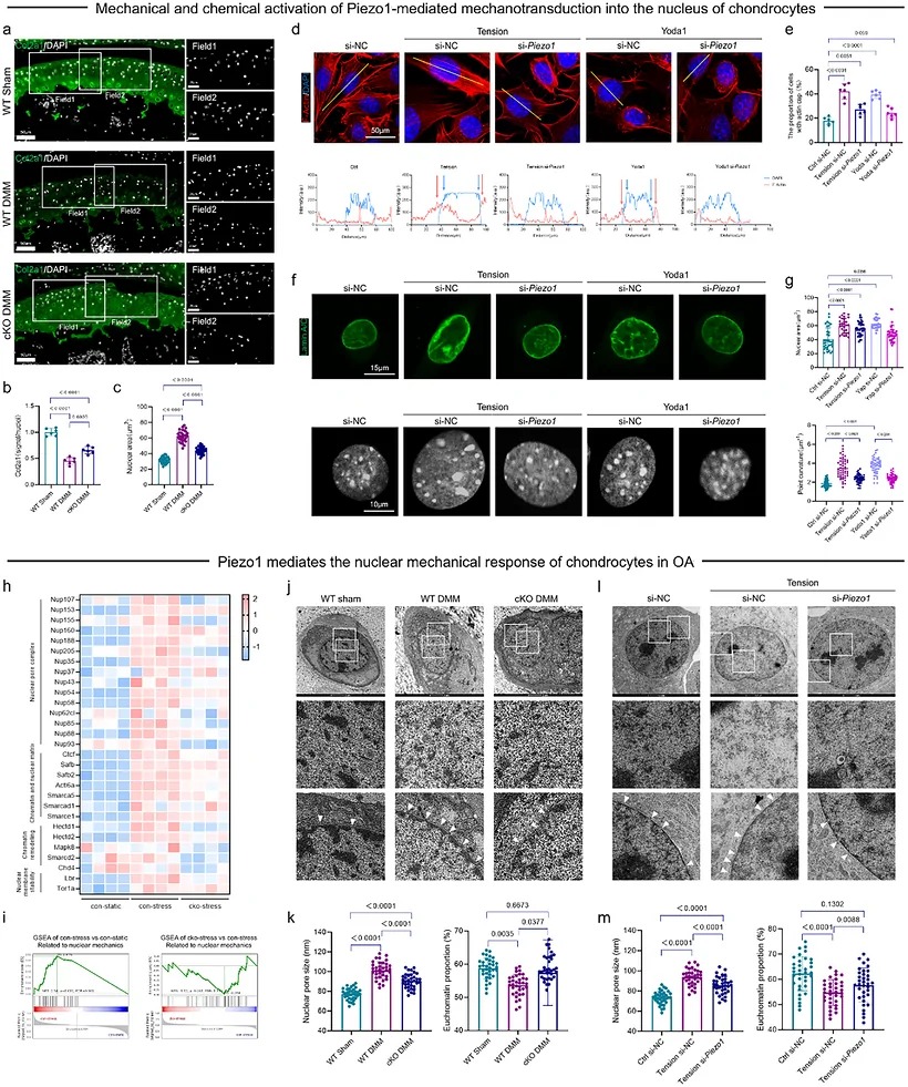 Piezo1 mediates nuclear mechanotransduction in osteoarthritis. (a) Immunofluorescence of Col2a1 and DAPI of WT Sham, WT DMM and cKO DMM groups. Scale bars: 50 and 20 um. (b) Quantification of COL2 fluorescence intensity of WT Sham, WT DMM and cKO DMM groups (n = 6). (c) Chondrocyte nuclear cross-sectional area of OA cartilage samples of COL2 of WT Sham, WT DMM and cKO DMM groups (n = 30 samples from six WT Sham, WT DMM or cKO DMM mice). (d) Immunofluorescence and co-localization analysis of F-Actin and DAPI of si-NC Ctrl, si-NC Tension, si-Piezo1 Tension, si-NC Yoda1 and si-Piezo1 Yoda1 groups. Scale bars: 50 um. (e) Percentage of cells with perinuclear actin cap of si-NC Ctrl, si-NC Tension, si-Piezo1 Tension, si-NC Yoda1 and si-Piezo1 Yoda1 groups (n = 6). (f) Immunofluorescence of LaminA/C and DAPI of si-NC Ctrl, si-NC Tension, si-Piezo1 Tension, si-NC Yoda1 and si-Piezo1 Yoda1 groups. Scale bars: 15 and 10 um. (g) Nuclear area of ATDC5 cells of si-NC Ctrl, si-NC Tension, si-Piezo1 Tension, si-NC Yoda1 and si-Piezo1 Yoda1 groups (n = 35 in si-NC Ctrl group, n = 30 in si-NC Tension group, n = 36 in si-Piezo1 Tension group, n = 29 in si-NC Yoda1 group and n = 35 in si-Piezo1 Yoda1 group). And point curvature of si-NC Ctrl, si-NC Tension, si-Piezo1 Tension, si-NC Yoda1 and si-Piezo1 Yoda1 groups (from 24 cells per group). (h) Heatmaps of nuclear mechanics related genes expression in con-static, con-stress and cko-stress groups (n = 4). (i) GSEA analysis of nuclear mechanics related pathways in con-static, con-stress and cko-stress groups. (j) TEM images of chondrocytes nuclei in WT sham, WT DMM and cKO DMM groups. (k) Quantification of nuclear pore size and the proportion of euchromatin of chondrocytes in WT sham, WT DMM and cKO DMM groups (from 35 cells per group). (l) TEM images of chondrocytes nuclei in si-NC Ctrl, si-NC Tension and si-Piezo1 Tension groups. (m) Quantification of nuclear pore size and euchromatin ratio of chondrocytes in si-NC Ctrl, si-NC Tension and si-Piezo1 Tension groups (from 35 cells per group). The p value is indicated on the statistical graph. Values are means +/- SDs. Multiple comparison was performed by one-way ANOVA with Tukey's post-hoc analysis.
