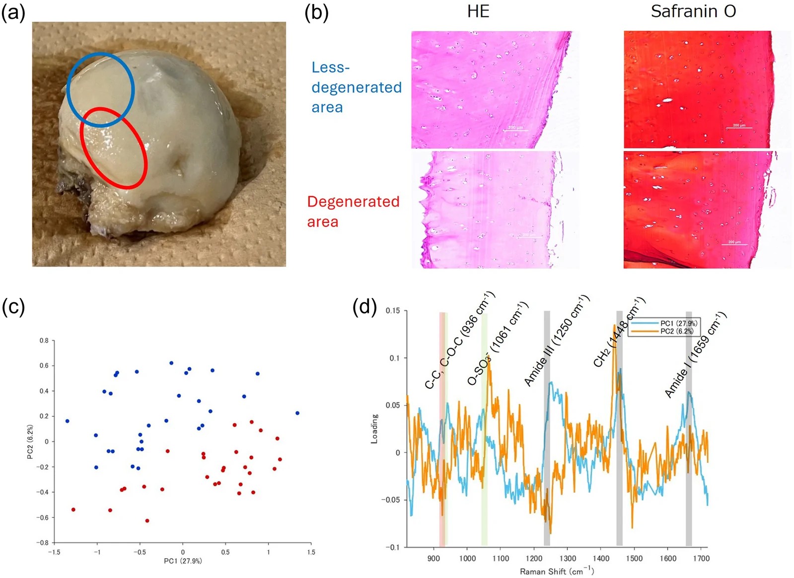 Representative specimens of human shoulder joint cartilage (humeral head). (a) macroscopic photograph, (b) H&E staining and Safranin O staining of tissue section. Safranin O stains proteoglycans red in cartilage matrix; H&E reveals the tissue architecture. Chondrocytes are visible within their lacunae distributed throughout the cartilage zones. Less-degenerated and degenerated areas are indicated.