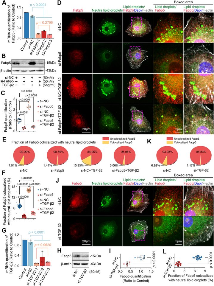 Fabp5 is a vital regulator in TGF-beta2-induced lipid droplet accumulation. A, qPCR showing that transfection with si-Fabp5-3 at 50 nM for 24 h efficiently knocked Fabp5 down in chondrocytes. Hprt served as the endogenous reference gene. Data from five independent experiments (n = 5) were analyzed by one-way ANOVA and are presented as mean +/- SD. B and C, Western blotting (B) and quantification (C) showing that transfection with si-Fabp5-3 at 50 nM significantly decreased Fabp5 protein expression in chondrocytes. D, representative immunofluorescence micrographs showing that Fabp5 knockdown decreased neutral lipids and lipid droplets in chondrocytes in the presence of TGF-beta2 at 5 ng/ml for 48 h. Neutral lipids and lipid droplets are labeled with BODIPY 493/503 (green), Fabp5 is visualized in red (Alexa Fluor 647), F-actin cytoskeleton is visualized with TRITC-phalloidin (gray, Em565), and nuclei are labeled with Dapi (blue). Scale bars: 20 um (first three columns) and 5 um (last two columns, enlarged images). J, Representative immunofluorescence micrographs showing that TGF-beta2 knockdown decreased neutral lipids and lipid droplets in chondrocytes. Neutral lipids and lipid droplets are labeled with BODIPY 493/503 (green), Fabp5 is visualized in red (Alexa Fluor 647), F-actin cytoskeleton is visualized with TRITC-phalloidin (gray, Em565), and nuclei are labeled with Dapi (blue). Scale bars: 20 um (first three columns) and 5 um (last two columns, enlarged images).