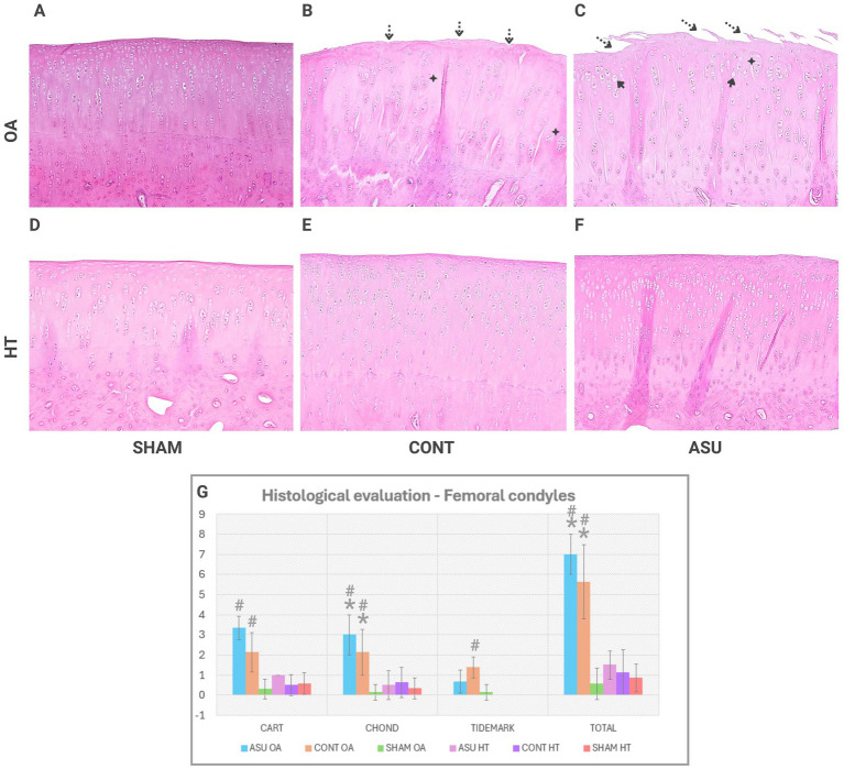 Histological cartilage evaluation in femoral condyles. Representative hematoxylin-eosin-stained sections of osteaoarthritic (OA) femoral condyles and their contralateral healthy (HT) from (A,D) SHAM: sham surgery, treated with placebo; (B,E) CONT: control, operated knees treated with placebo; (C,F) ASU: operated knees treated with avocado/soybean unsaponifiables. (G) The bar graph shows semiquantitative histological scores for cartilage structure (CART), chondrocyte abnormalities (CHOND), tidemark integrity (TIDEMARK), and total score (TOTAL) in the previously mentioned groups. Asterisks (*) indicate significant differences with the contralateral HT joint and the hash (#) indicates significant differences with the SHAM-OA group. Four-point stars denote chondrocyte clusters, black arrows denote empty lacunae, and dashed arrows denote surface undulations and irregularities.