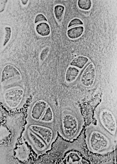 Hypertrophic zone of the epiphyseal growth plate, light microscopy. Large hypertrophic chondrocytes in lacunae with calcified matrix visible. Demonstrates the transition from proliferative to hypertrophic zone preceding ossification.