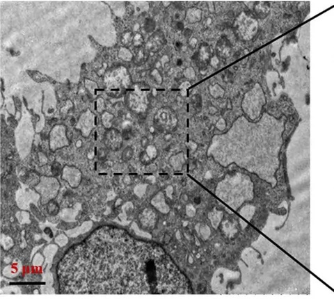 Effect of Cd exposure on ER-phagy and changes in ER-phagy after inhibition of ERS. (A) ER autophagosomes were observed under transmission electron microscopy. The red arrows refer to ER autophagosomes; (B) Western blot of FAM134B; (C) Western blot of FAM134B after inhibition of ERS; (D) Statistical chart of FAM134B expression; (E) Statistical chart of FAM134B expression after inhibition of ERS. (rat (BRL-3A liver cells, Cd-treated); Figure 5A (TEM panel; rows 33-462, cols 76-555 of figure).)