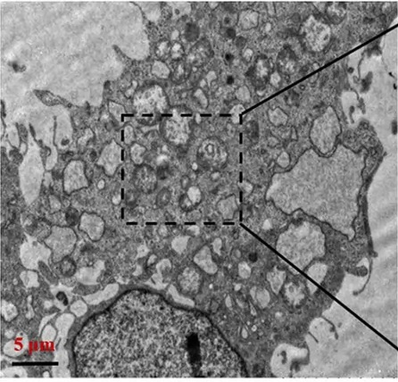 ER autophagosomes (ER-phagy) by transmission electron microscopy, boxed region magnified elsewhere in the source figure. Scale bar 5 um.