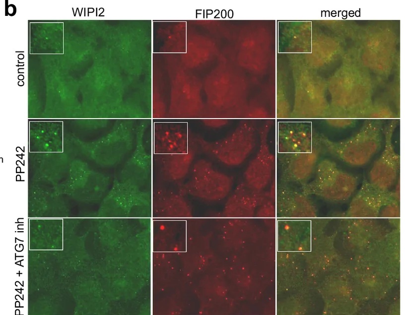 PtdIns3P production is reduced by inhibiting its downstream mATG8 lipidation machinery in cells. b HEK293 cells were treated as in panel a , but were double-stained with antibodies to endogenous FIP200 and endogenous WIPI2 as shown. Image acquisition and any intensity corrections were done to the same extent for both channels.