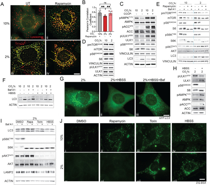 Assessment of autophagosome-lysosome fusion, metabolic status, and nutrient stress response under different CO2 conditions. (A) Representative images showing colocalization of LC3 (green) and lysosomes (red) in cells cultured under (i) 10% CO2, (ii) 10% CO2+Rapamycin, (iii) 2% CO2 or (iv) 2% CO2+Rapamycin. Yellow indicates merged signal (colocalized vesicles); arrows highlight LC3-lysosome overlap. Scale bar: 10 um.