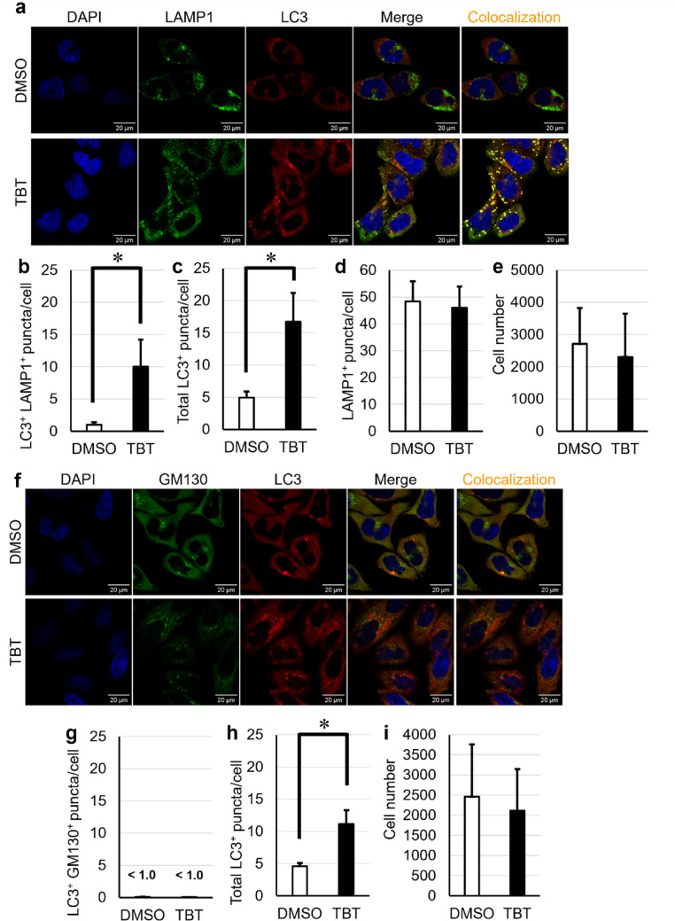 TBT triggers LC3 recruitment to lysosomes, but not to the Golgi apparatus. a - e FIP200-knockout (KO) HeLa cells were treated with 700 nM TBT for 6 h. Confocal images were stained for LC3 and LAMP1. Colocalized puncta (LC3+ and LAMP1+) are highlighted in yellow. Scale bars are 20 um. f-i FIP200 KO HeLa cells were treated with 700 nM TBT for 6 h. Confocal images were stained for LC3 and GM130 (cis-