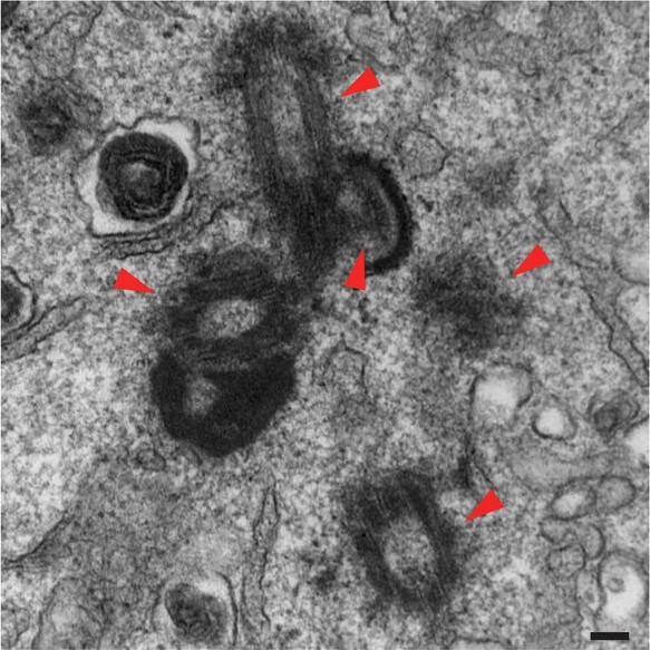 TEM image of undocked supernumerary centrioles in a cKO spermatid. TEM image of a P26 testis section showing a step 9 cKO spermatid containing five centrioles (red arrowheads). An enlarged view of the boxed region is shown on the right. Scale bars, 2 µm and 100 nm (enlarged images). (mouse (Stra8-iCre;Cep164 fl/fl spermatid, P26 testis); Figure EV2, right (enlarged view, 100 nm scale bar; cols 765-1347 of figure).)