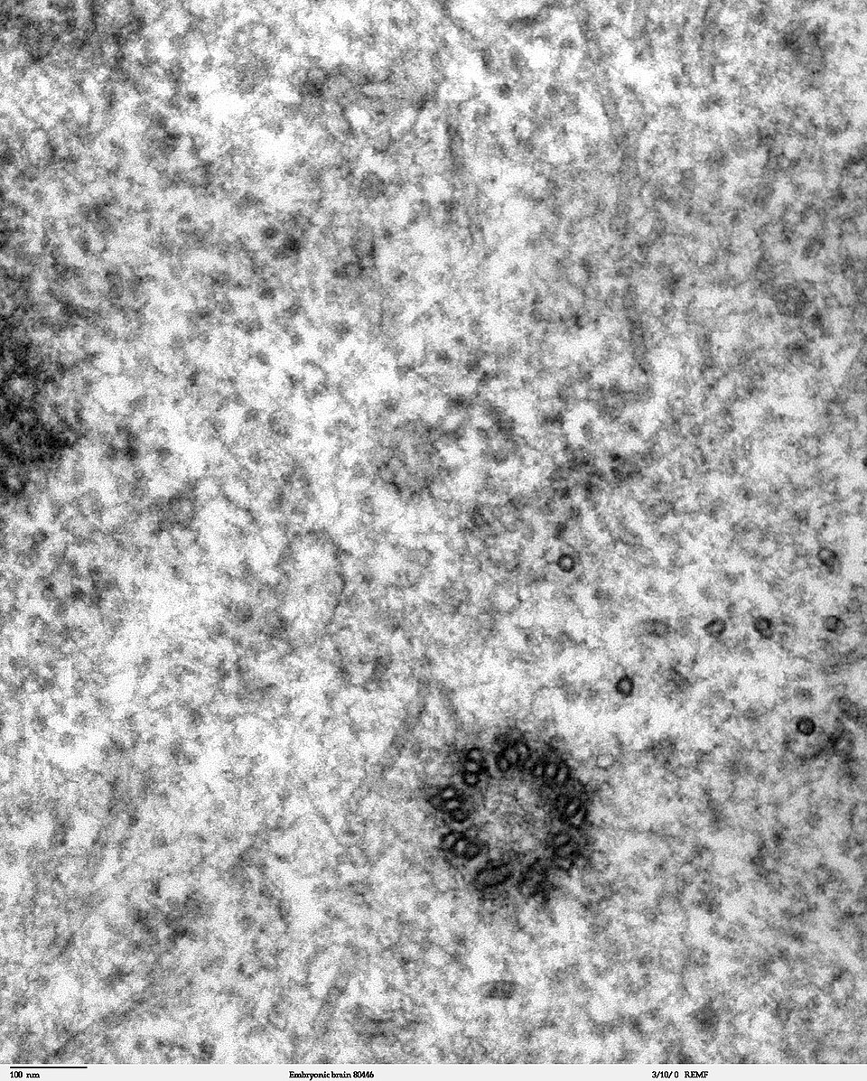 Transmission electron microscope image of a thin section cut through the developing brain tissue (telencephalic hemisphere) of an 11.5 day mouse embryo. This high magnification image of "Embryonic brain 80445" show a spindle centriole and some spindle microtubules visible in the cytoplasm of a mitotic cell at the luminal surface of the telencephalon.