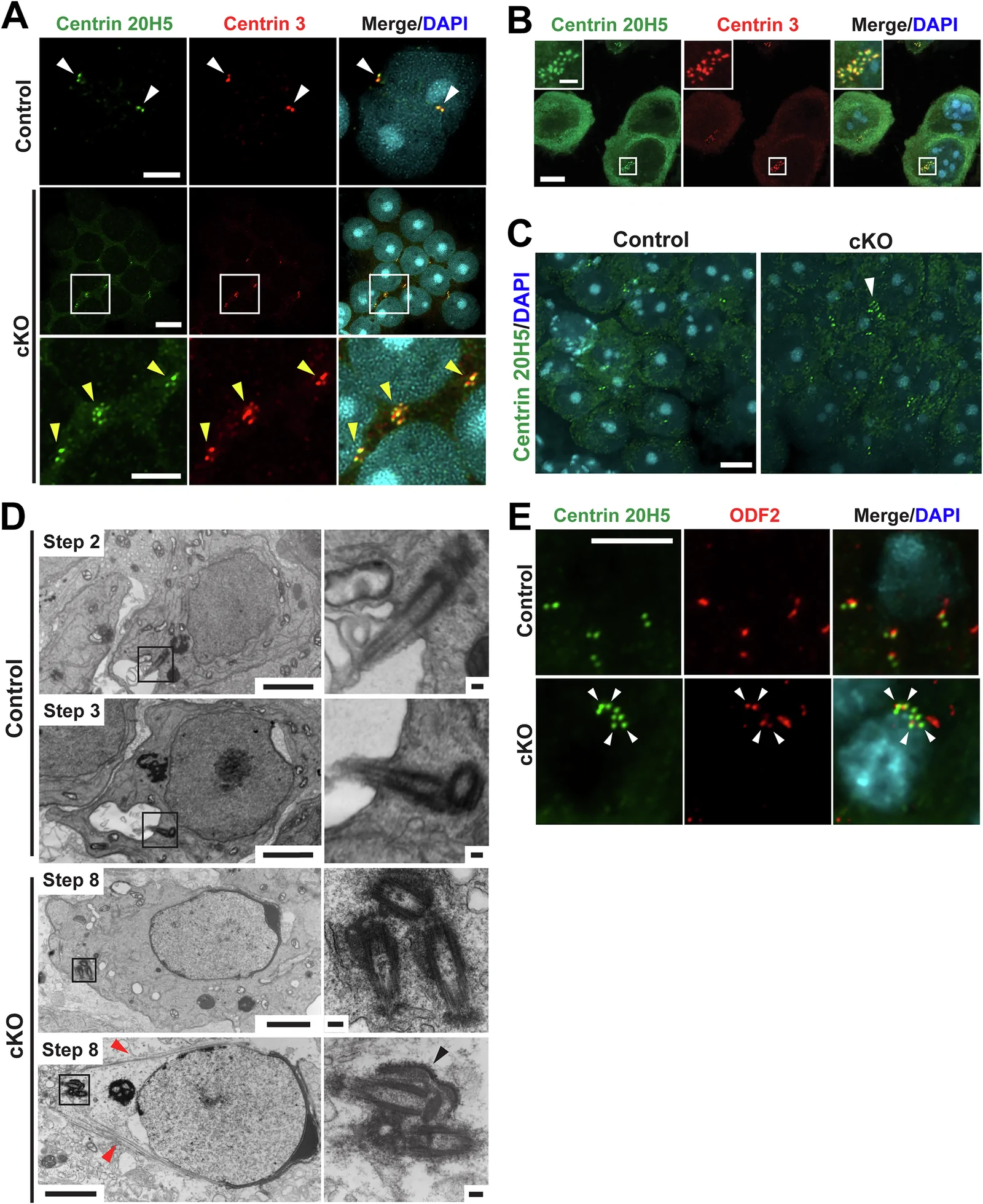 Abnormal clustering of supernumerary centrioles in cKO spermatids. ( A , B ) IF staining of chromosome spreads from cKO testes using Centrin 20H5 and Centrin 3 antibodies. ( A ) In control round spermatids, two centrioles are typically present (white arrowheads). In contrast, cKO round spermatids exhibit abnormal aggregates of multiple centrioles (yellow arrowheads). Enlarged views of boxed region