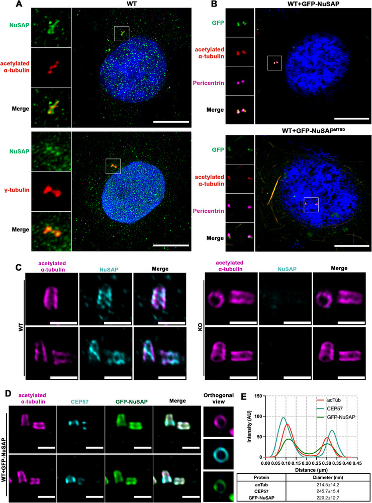 NuSAP possesses a centrosomal localization. (A) HeLa cells were synchronized in the G2 phase and stained for IF with antibodies against NuSAP (green) and (upper panel) acetylated alpha-tubulin (red) with a 1-h cold treatment before fixation to remove unstable microtubules or (lower panel) gamma-tubulin (red). Scale bar, 10 um. (B) HeLa cells with GFP-NuSAP and GFP-NuSAP MTBD overexpression were synchronized in the G2 phase and stained for IF with antibodies against acetylated alpha-tubulin (red) and pericentrin (magenta) with a 1-h cold treatment before fixation.