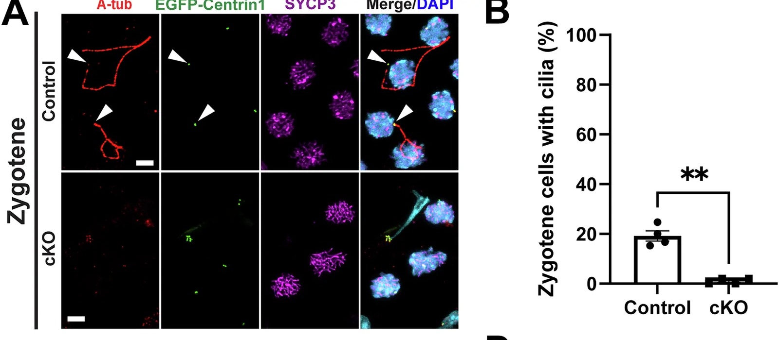 Loss of zygotene cilia does not overtly affect meiotic chromosome pairing or DNA repair. (A) IF staining of seminiferous tubule squashes from control or cKO mice expressing EGFP-Centrin1 (centriole marker) with antibodies against A-tub and SYCP3 (meiotic chromosomal axis marker). Arrowheads indicate basal bodies extending primary cilia in zygotene cells. Scale bar, 5 um. Adapted: IF panel A only; quantification panel B and chromosome spread panels C-H excluded. (mouse (seminiferous tubule spermatocytes, CEP164-cKO); Figure 3, panel A only (IF of centrioles and primary cilia; quantification panel B and chromosome spread panels C-H excluded; rows 10-710 of full figure, 1600x700).)