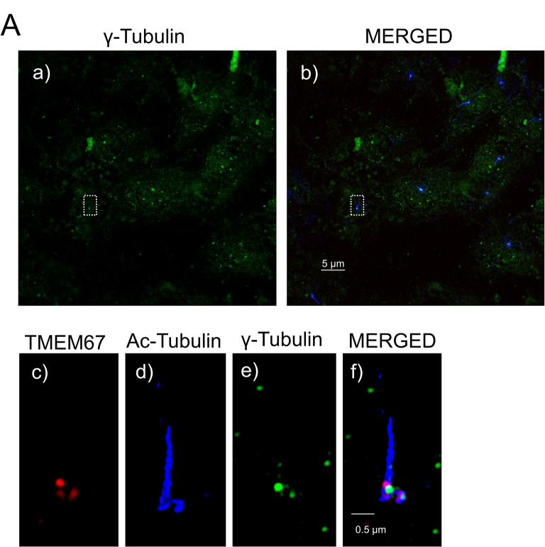 Performance of AAP purified gamma-Tubulin Antibody. ( A ) Immunofluorescence staining showing AAP purified gamma-Tubulin (#D-0006-100UG) performance in ciliated NIH-3T3 cells. Merged images including gamma-Tubulin (green), anti-acetylated tubulin (blue), and anti TMEM67 (red). The white square outlines a representative ciliary structure used for higher magnification in c-f. Scale bar represents 1 μm.