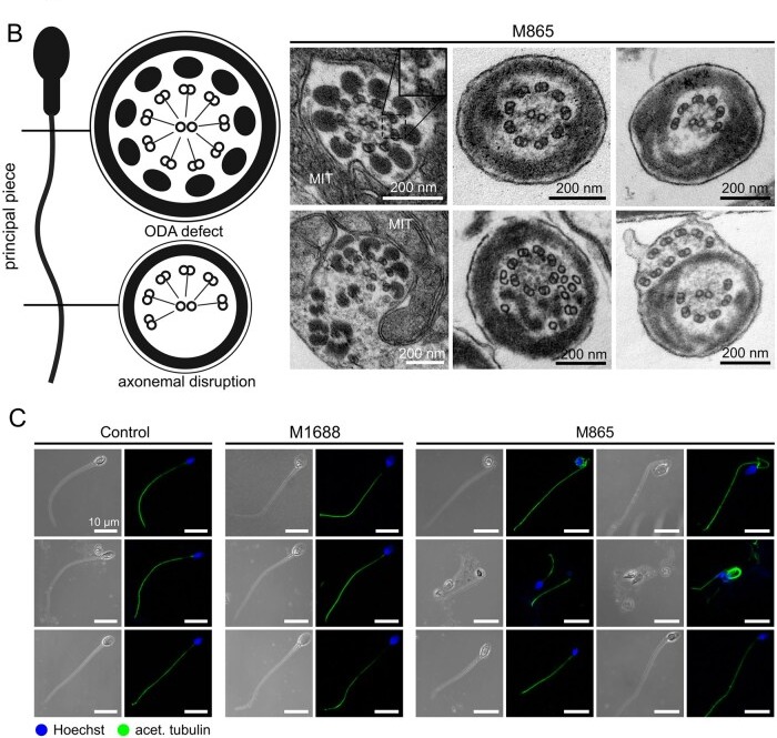 TEM images of axonemal cross sections of human sperm flagella. Panel A, right: sperm from M1688, M1344, and M1670; arrows point to examples of outer dynein arms (ODAs). Panel B, right: sperm from M865, with causal DNAH17 variants, clearly show an absence of ODAs as well as axonemal disruption, including missing or supernumerary and misplaced microtubule doublets. Scale bar, 200 nm. (human (sperm flagellum); Figure 2, TEM panels A right and B right.)
