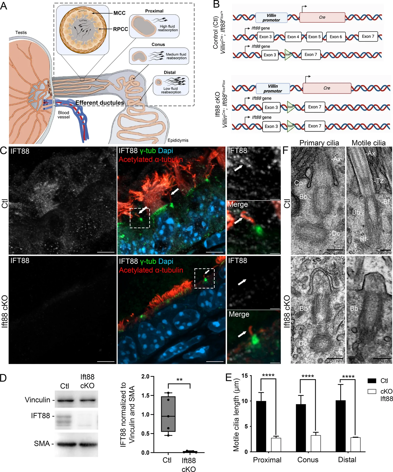 Loss of IFT88 in Villin-Cre mice impairs ciliogenesis in the efferent ductules. A Gross anatomy of the reabsorptive mouse efferent ductules showing the proximal, conus, and distal segments. While the proximal segment, adjacent to the rete testis, consists of convoluted tubules, the distal segment converges into a single duct connecting to the epididymis. Its epithelium is composed of two main cell types: multiciliated cells (MCC) and reabsorptive primary ciliated cell (RPCC) that ensure sperm concentration through fluid reabsorption. C Immunofluorescent staining of efferent ductules from adult Ctl and Ift88 cKO mice showing IFT88 (gray), γ-tubulin (γ-tub, green) marking centrioles/basal bodies, and Acetylated α-tubulin (red) labeling axoneme in primary (arrow) and motile cilia. F Ultrastructural components of primary and motile cilia, including the basal body (Bb), axoneme (Ax), daughter centriole (Dc), transition zone (Tz), and basal foot (Bf), in the efferent ductules of control and Ift88 cKO mice by transmission electron microscopy (TEM).