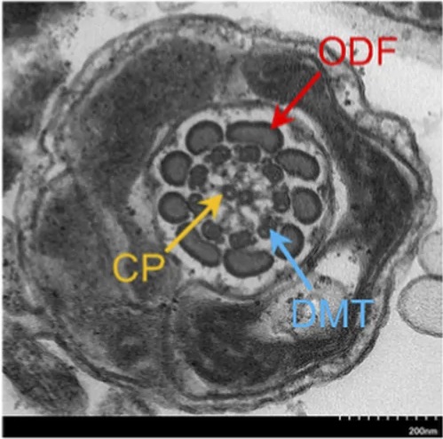 Transverse section of a fertile control sperm flagellum by TEM, labeled with the central pair (CP), outer dense fibers (ODF) and doublet microtubules (DMT), showing the canonical 9+2 axonemal organization. Scale bar 200 nm.