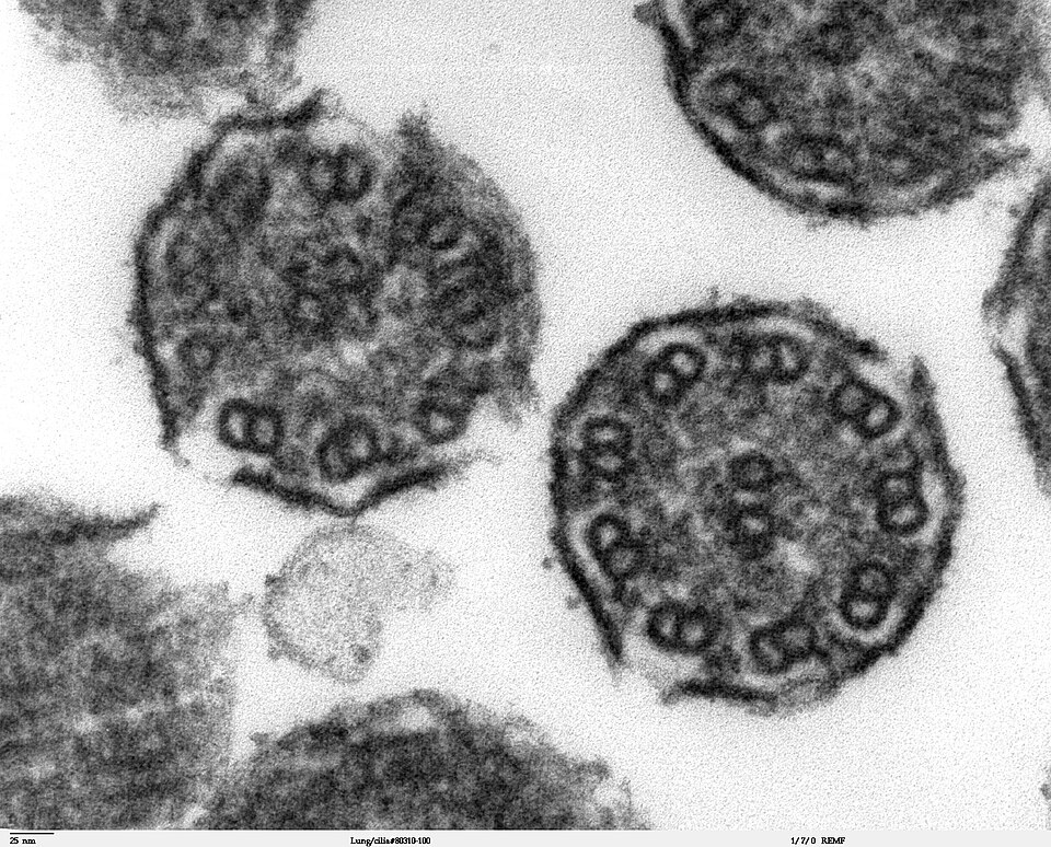 High magnification of "Lung cilia#80311-50" image. This image is a thin x-section cut through cilia. The inside of the cilium contain precisely arranged microtubules, the axoneme. The axoneme has a central unit containing two single microtubules and nine peripheral doublet microtubules (known as the "9+2"). Dynein sidearms project from the A tubule of each doublet.