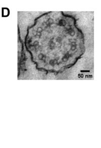 Cross-section of a normal tracheal axoneme by TEM, panel D of a figure comparing wild-type and Armc2-knockout ciliary axoneme structure. Scale bar 50 nm.