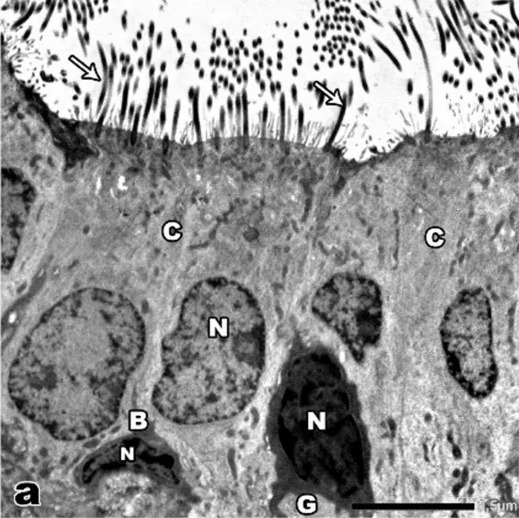 The tracheal pseudostratified columnar ciliated epithelium reveals the columnar ciliated cells (C), the more electron-dense goblet cells (G), and basal cells (B). The columnar ciliated cells contain rounded to oval euchromatic nuclei (N) with small patches of peripheral heterochromatin. Regularly arranged cilia (arrows) are present. (rat (trachea); Fig. 9a.)