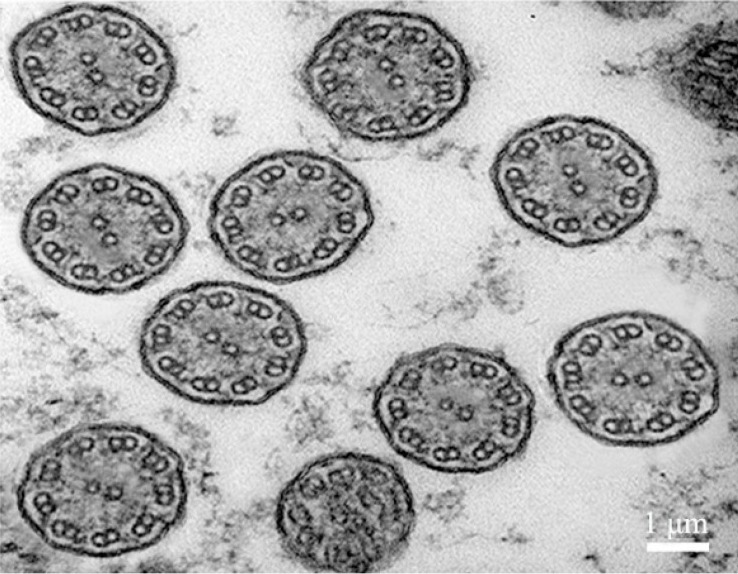 Transmission electron microscope observation of the body surface cilia in trochophore larva of U. unicinctus .
