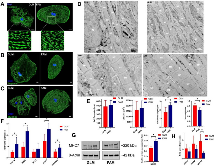 Fatty acid substrates enhance the morphological and structural maturation, and upregulate gene and protein expression in hiPSC-CMs. (A-C) Representative immunostaining of sarcomeric markers, including alpha-actinin (green), cTnT (green), and myosin (green) in hiPSC-CMs. Cells cultured in FAM exhibit well-defined, aligned sarcomeric striations indicative of structural maturation, in contrast to the less organized morphology in GLM. Scale bar = 20 um. (D) Representative transmission electron microscopy images of GLM- and FAM-cultured hiPSC-CMs reveal improved alignment of myofilaments (MF) and Z-lines (Z), with more organized banding and sarcomeric structure in the FAM group. Key features are mitochondria (M), myofilaments (MF), Z-lines (Z), and nucleus (N). (E) Quantitative assessment of cell structural parameters. FAM-cultured hiPSC-CMs show significantly increased cell perimeter, cell area, and sarcomere length, along with a decreased circularity index, compared to GLM-cultured CMs (n = 40 cells from 3 independent experiments). (F) Quantitative real-time PCR analysis of structural gene expression. FAM-cultured CMs exhibit significantly elevated expression of TNNT2, TNNI3, MYH7, and MYBPC3. (G) Western blot analysis of beta-MHC protein expression shows increased levels in FAM-cultured CMs. beta-actin was used as the loading control (n = 3 independent batches). *Data are presented as mean +/- SEM. Statistical analysis was performed using unpaired two-tailed Student's t-test. p < 0.05 indicates statistical significance. (Fig. 2.)