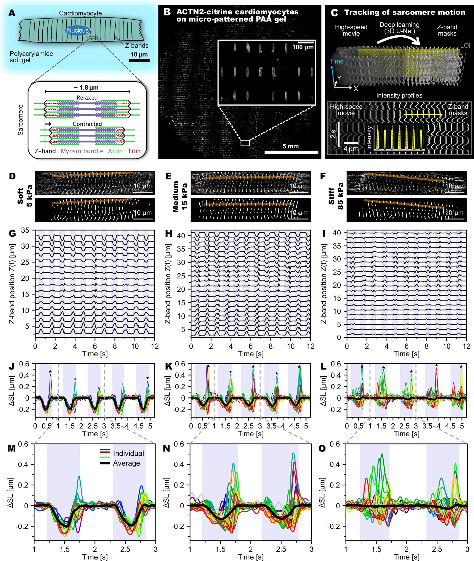 Sarcomere tracking in genetically engineered Z-line labeled induced pluripotent stem cell (iPSC)-derived cardiomyocytes (CMs) on micropatterned soft gels. (A) Sketch of a human CM adhering to a micropatterned gel (top) and sarcomere structure in relaxed and contracted state (bottom). (B) ACTN2-Citrine CMs (culture day 20) on a polyacrylamide gel substrate (Young's modulus: 15 kPa), patterned with rectangular stripes of Synthemax (70 x 10 um). More than 50% of the stripes were typically occupied by single CMs. Inset: zoomed-in view. (C) Tracking of sarcomere motion: (Top) Blend of high-speed confocal movie of a CM adherent to a 15-kPa substrate (left) and deep-learning (3D U-Net)-based segmentation of sarcomere Z-bands (right) with line of interest (LOI, yellow). (Bottom) Intensity extracted along LOI. Inset shows representative section of the Z-band intensity profile. (D, E) Confocal images of representative ACTN2-Citrine-labeled CMs with corresponding Z-band segmentation and LOIs (red lines). (G-I) Z-band trajectories tracked along the LOI. (J-O) Overlay plots of single-sarcomere length change dSL(t) for all tracked sarcomeres in the marked LOIs (first 5 s in J-L, zoomed in M-O). Colored lines are individual sarcomere length changes; black lines display average length changes. Contraction intervals are marked by a blue background. Sarcomere popping events are marked with asterisks. Conditions (substrate stiffness): 5 kPa (D, G, J, M); 15 kPa (physiological) (E, H, K, N); 85 kPa (F, I, L, O). (Figure 1.)