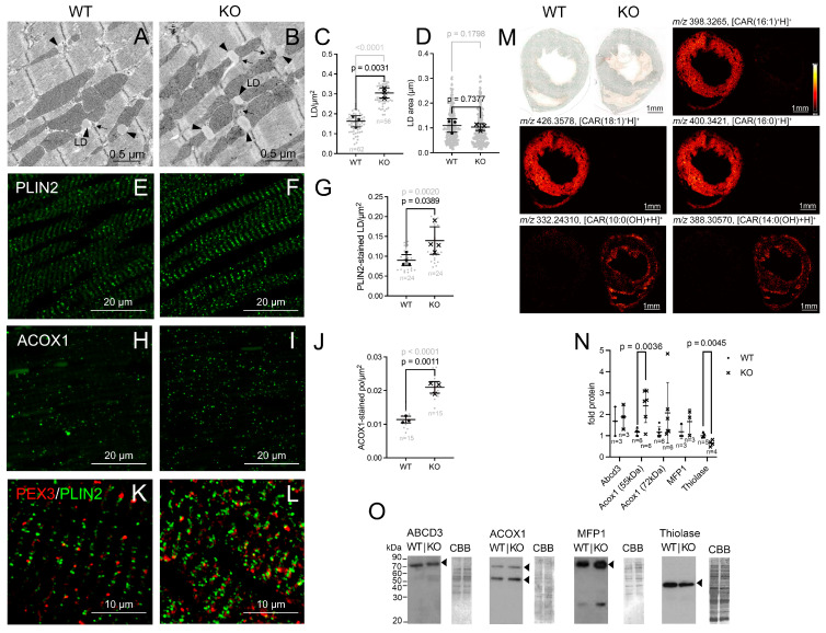 Lipid storage and metabolism are compromised in the hearts of the Pex11a knockout mice. ( A , B ): Electron micrographs of LDs (black arrowheads) and POs (black arrows) in LV cardiomyocytes of wild-type and knockout mice. ( C , D ): LD abundance ( C ) (calculated from "n" images as indicated in the graph) and size ( D ) (calculated from 233 LDs) derived from 3 mice/genotype. ( E , F ): IFA of PLIN2 in LVs. ( G ): Abundance of PLIN2-stained LDs in wild-type and knockout LVs calculated from 4 mice/genotype. (mouse (wild-type and Pex11a knockout left ventricular cardiomyocytes); Figure 5.)
