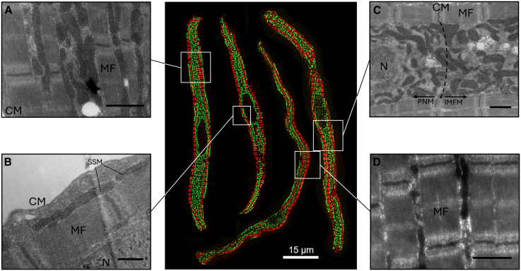 Structural organization of uninfected ex vivo ventricular cardiomyocytes at 6 weeks post-infection. The central panel shows a composite fluorescence microscopy image of cardiomyocytes stained with MitoTracker Green (mitochondria) and CellMask Deep Red (actin). Insets correspond to regions highlighted in transmission electron micrographs (TEM) from other samples. Mitochondria are loosely packed in the cardiomyocyte core, surrounded by a myofibril sheath, and may align parallel to adjacent actin myofibrils. (A) Mitochondria arranged between myofibrils (MF), oriented roughly parallel to the myofibrils. A circular void at the bottom likely represents a lipid droplet dislodged during ultra-fine sectioning. (B) A small fraction of mitochondria are positioned directly beneath the cell membrane (CM), labeled as subsarcolemmal mitochondria (SSM), with a visible nucleus (N). (C) Loosely packed mitochondria within the cardiomyocyte core, surrounded by a myofibril sheath. Mitochondria near the nucleus, identified as perinuclear mitochondria (PNM), while those further away are classified as intermyofibrillar mitochondria (IMFM), both indicated by arrows. The dotted line demarcates an arbitrary boundary between the PNM and IMFM regions. (D) A fraction of mitochondria within the myofibril sheath showing mammalian-like orientation, with tight contact between mitochondria and myofibrils. All TEM images were acquired from resin-embedded, stained 70 nm sections. Scale bars: 1000 nm (A-C) and 500 nm (D). (Atlantic salmon (ex vivo ventricular cardiomyocytes isolated from Salmo salar at 6 weeks post-infection); Figure 5.)