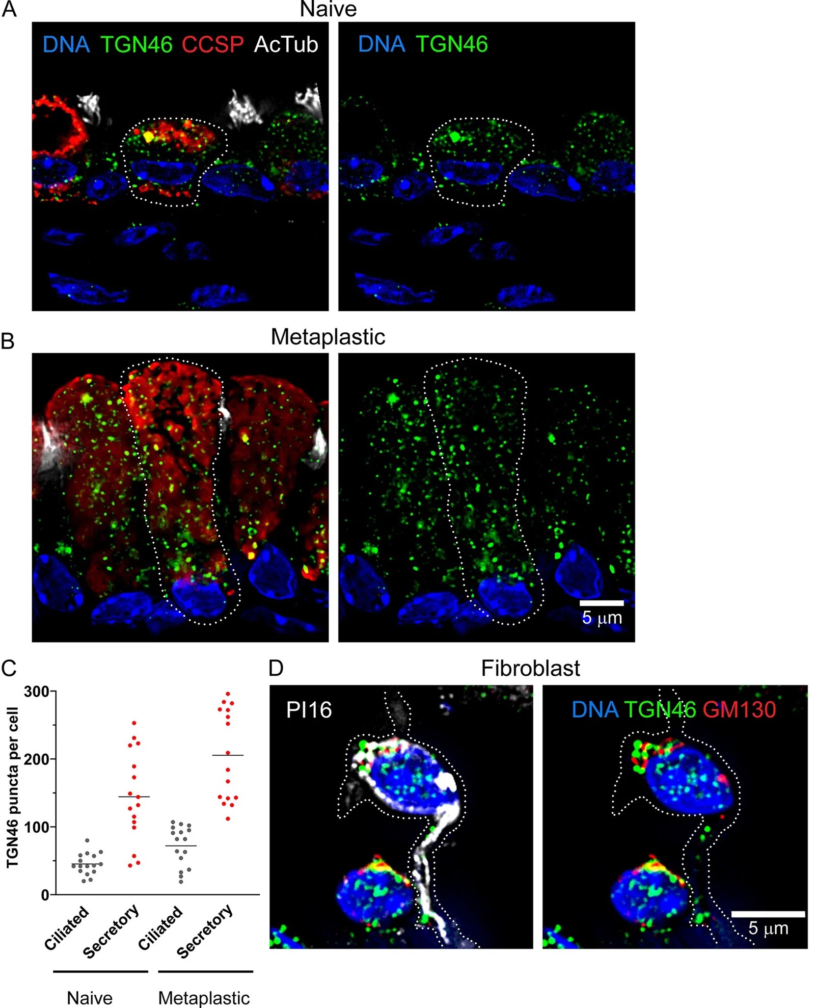 Immunofluorescence staining for GM130 in human airway secretory cells reveals the Golgi apparatus as a characteristic perinuclear ribbon with additional distributed Golgi outposts scattered throughout the cytoplasm. (Homo sapiens (airway secretory cells).)
