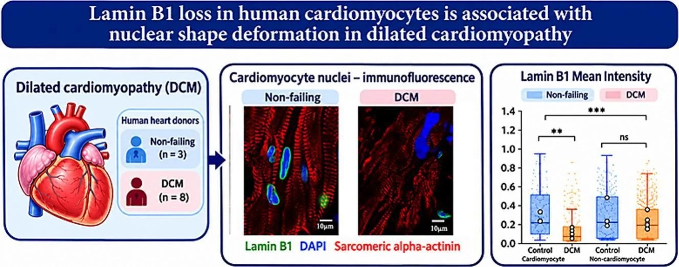 Immunofluorescence staining for lamin B1 outlines the nuclear lamina as a continuous ring in human iPSC-derived cardiomyocytes, with smooth nuclear contours visible in control cells prior to lamin B1 depletion. (Homo sapiens (iPSC-derived cardiomyocytes).)